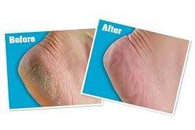 O'Keeffe's Healthy Feet Voetcrème