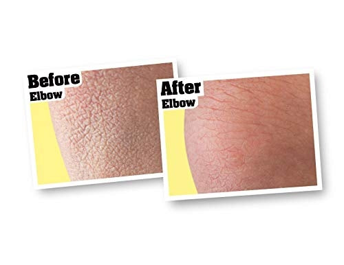 O’Keeffe’s Skin Repair
